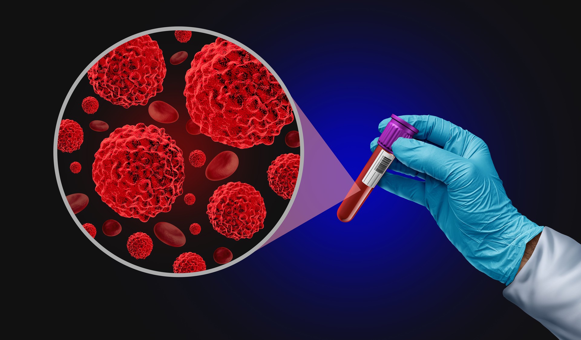 Blood Cancer Screening